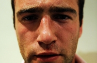 Guy Burgoyne is seen after a fight